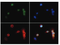 H3K18me2 | Histone H3 (dimethylated Lys18) in the group Antibodies Plant/Algal / DNA/RNA/Cell Cycle / Epigenetics/DNA methylation at Agrisera AB (Antibodies for research) (AS16 3182)